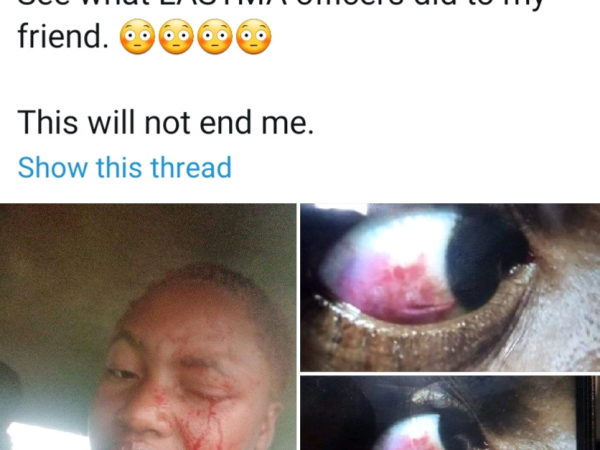 Woman Suffers Eye Injury After A Lastma Official Allegedly Assaulted Her | MarvelTvUpdates