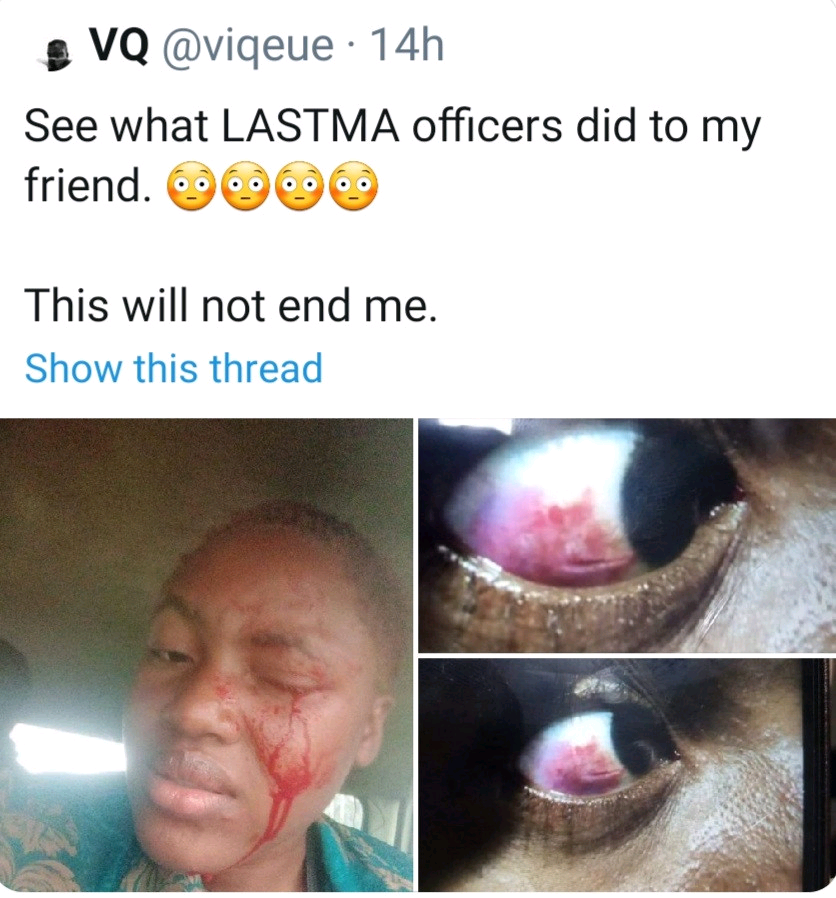 Woman Suffers Eye Injury After A Lastma Official Allegedly Assaulted Her | MarvelTvUpdates