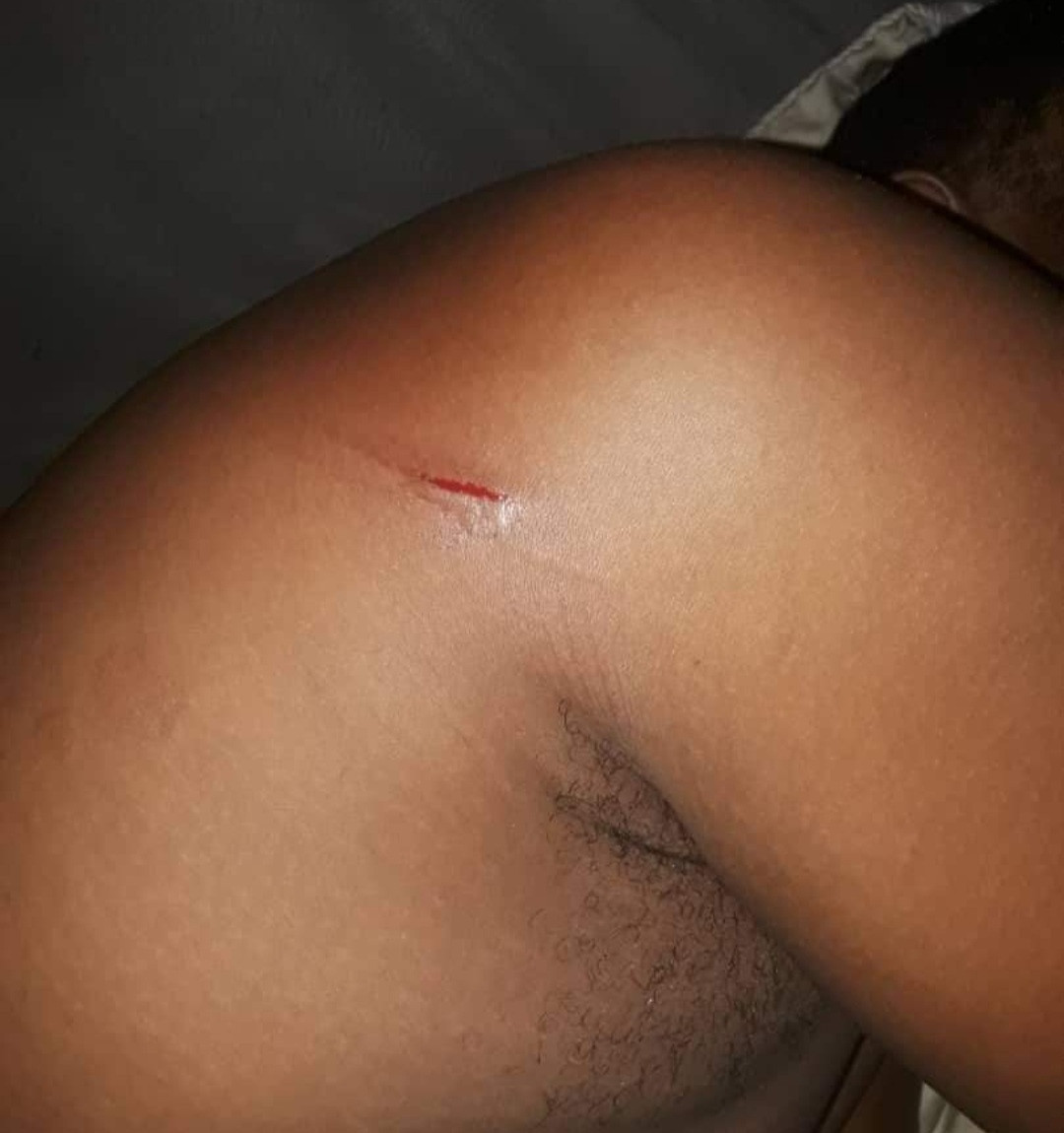 Nigeria Man Who Dreamt Of Being Cut With A Knife, Woke Up And Saw The Spot Bleeding Asked Followers For Prayers | MarvelTVUpdates