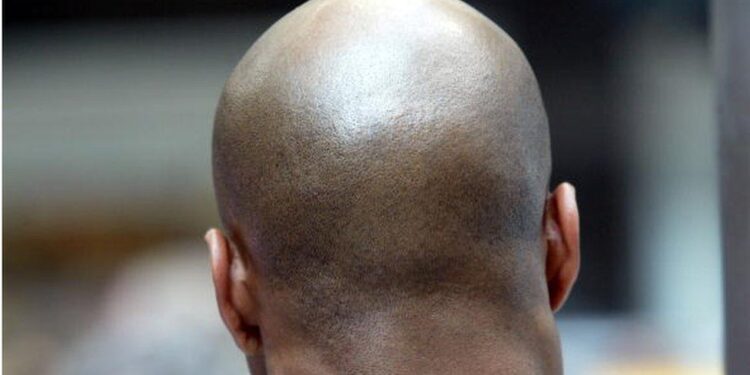 Ritualists Now Target Bald Men, Believe Their Heads Contain Gold – Police Warns