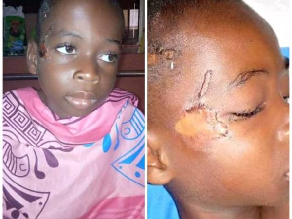 Little Boy Severely Abused, Bruised And Left Naked In Bush In Akwa Ibom | MarvelTvUpdates