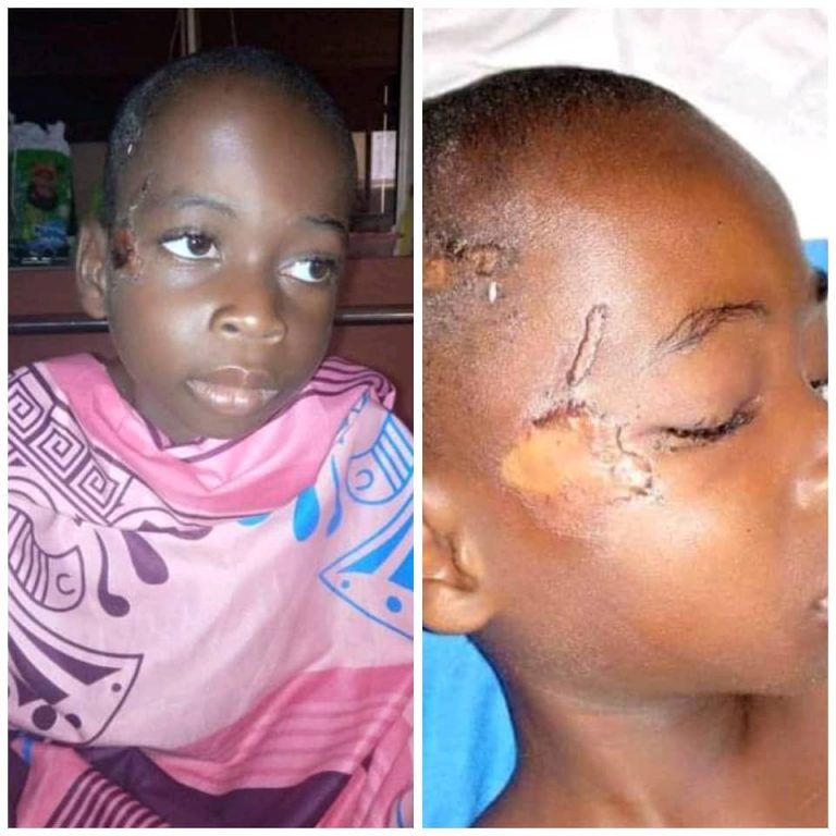 Little Boy Severely Abused, Bruised And Left Naked In Bush In Akwa Ibom | MarvelTvUpdates