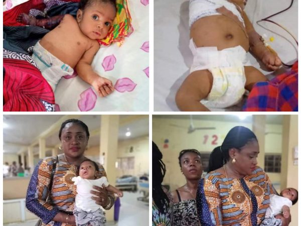 [PHOTOS]: Father Allegedly Beats His 2-Month-Old Son With Hanger In Imo For Disturbing His Sleep, Breaks The Baby’s Arm Leading To Amputation | MarvelTvUpdates