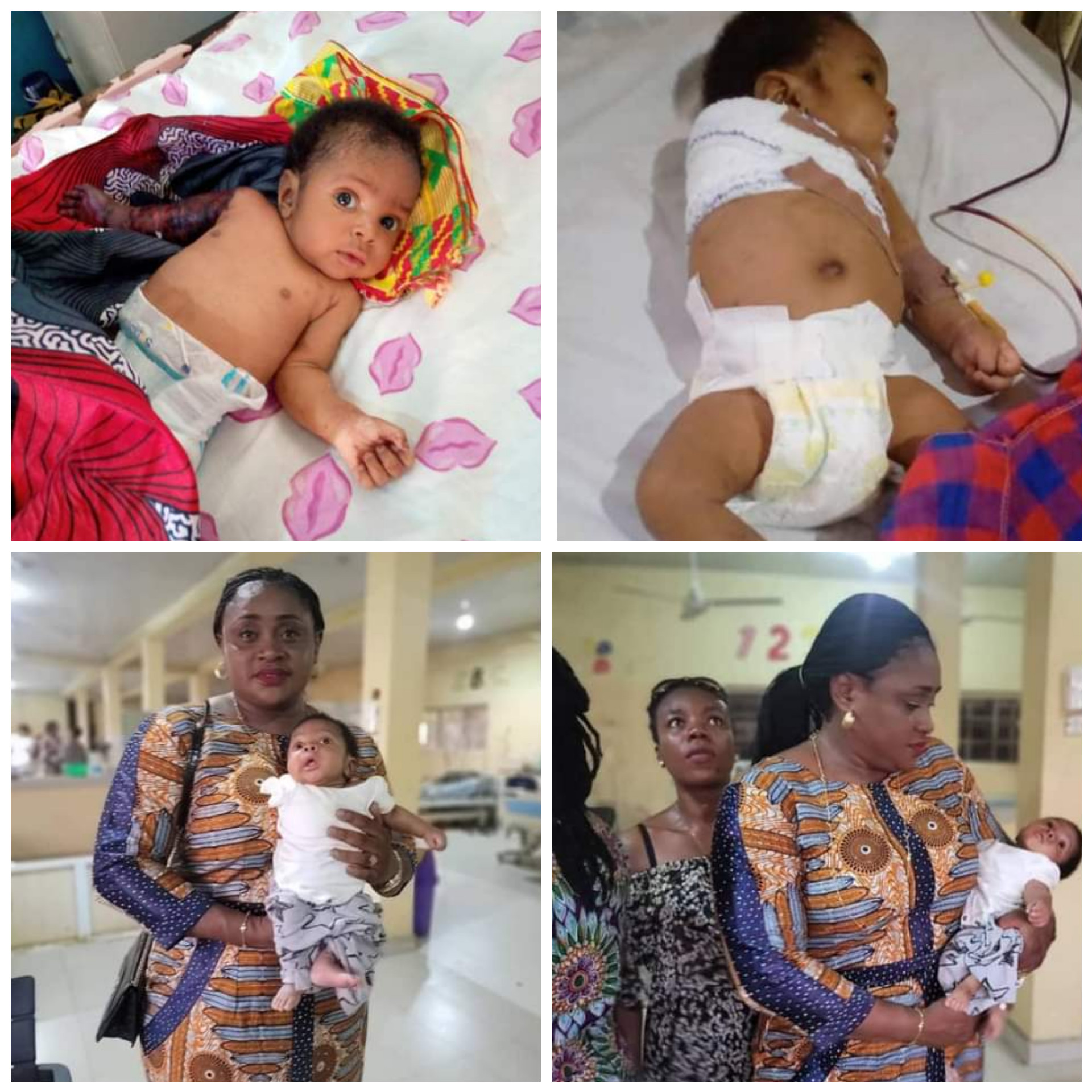 [PHOTOS]: Father Allegedly Beats His 2-Month-Old Son With Hanger In Imo For Disturbing His Sleep, Breaks The Baby’s Arm Leading To Amputation | MarvelTvUpdates