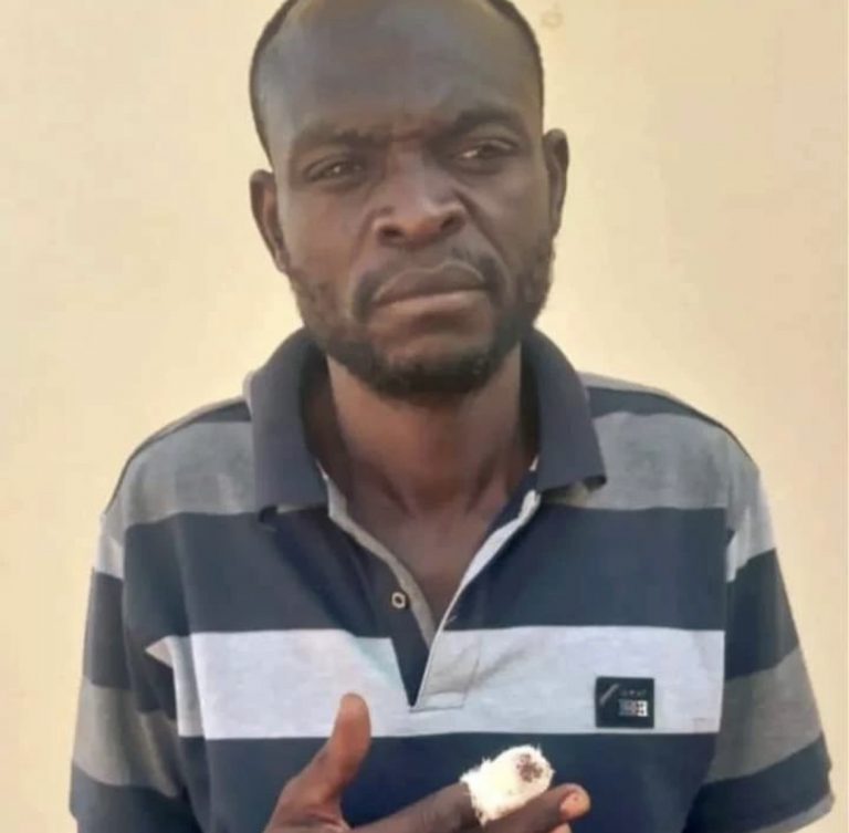 18-Year-Old Boy Bites Off Finger Of A 50-Year-Old Man, For Staring At His Mother | MarvelTvUpdates