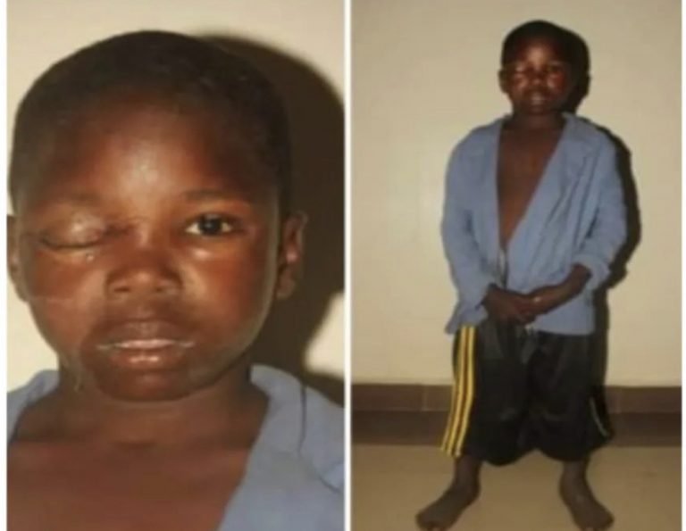 Suspected Ritualist Remove 12-Year-Old Boy’s Eye In Bauchi | MarvelTvUpdates