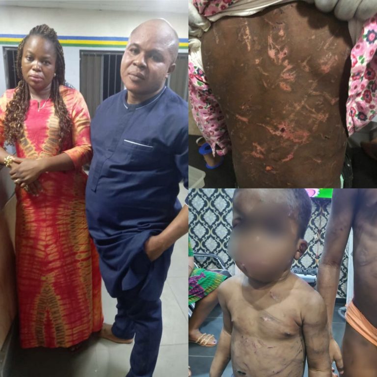 See Horrifying Images Of The Battered Bodies Of The Woman And Her Partner, Who Were Arrested For Allegedly Beating Her 2 Children, Who Are Ages 5 And 2 (PHOTOS) | MarvelTvUpdates