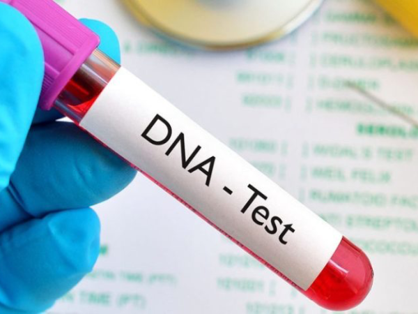 DNA Testing On The Rise: Yoruba People Show Highest Increase | MarvelTvUpdates