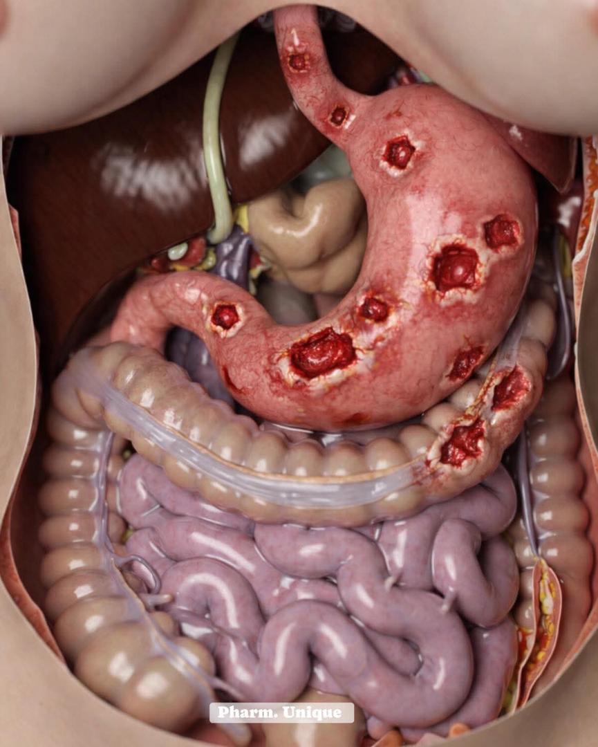 4a15393c-f402-4021-a430-f5719a46d7ea